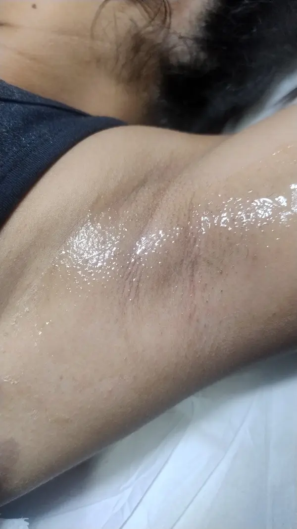 Depilação em cera