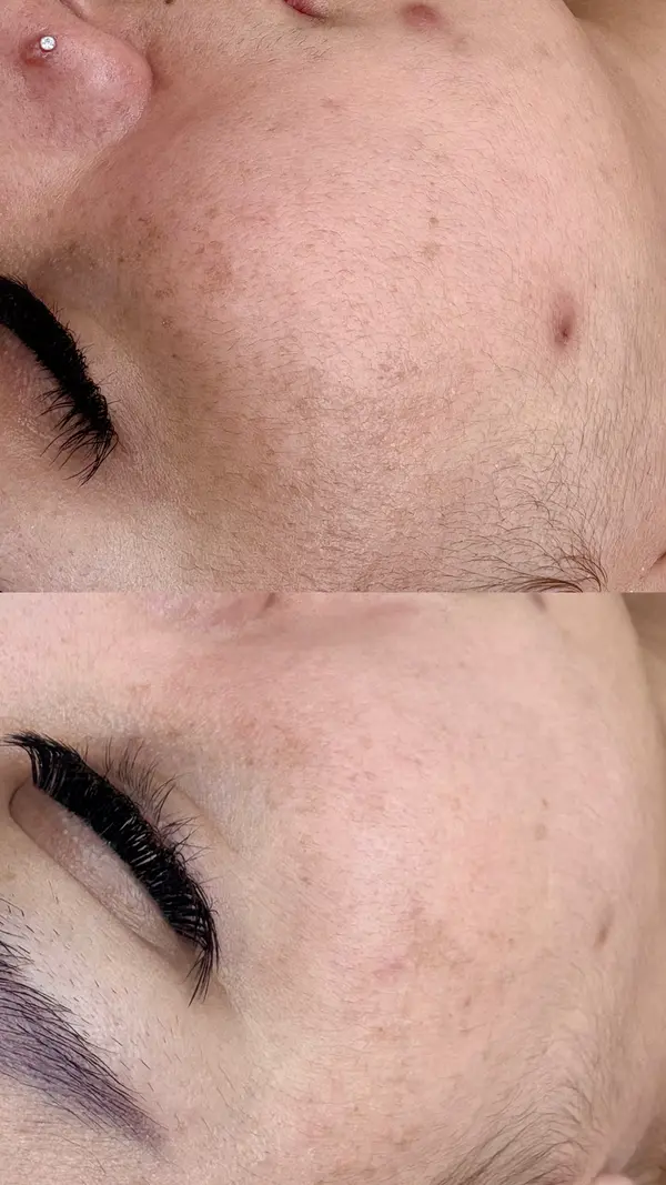 Estética corporal e facial