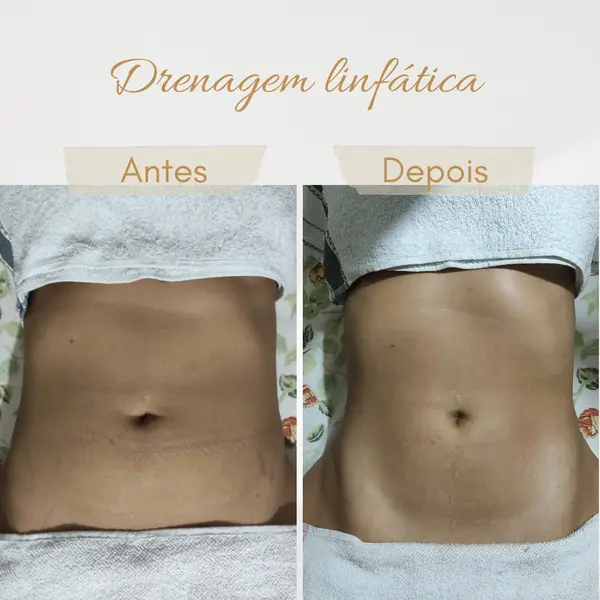 Estética corporal e facial