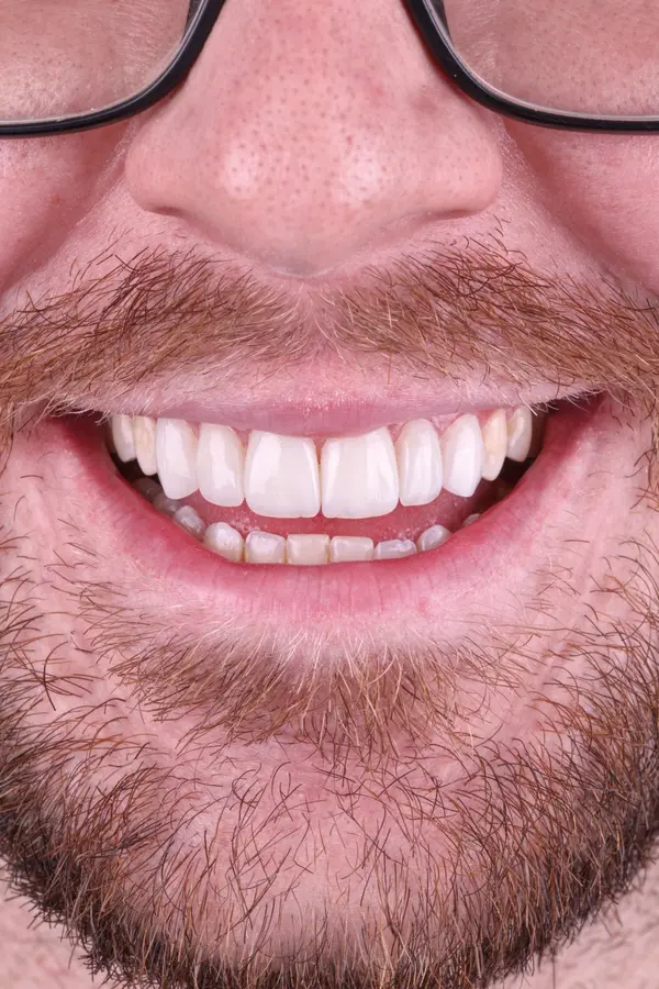 Dentista Especialista em Estética e Saúde Bucal